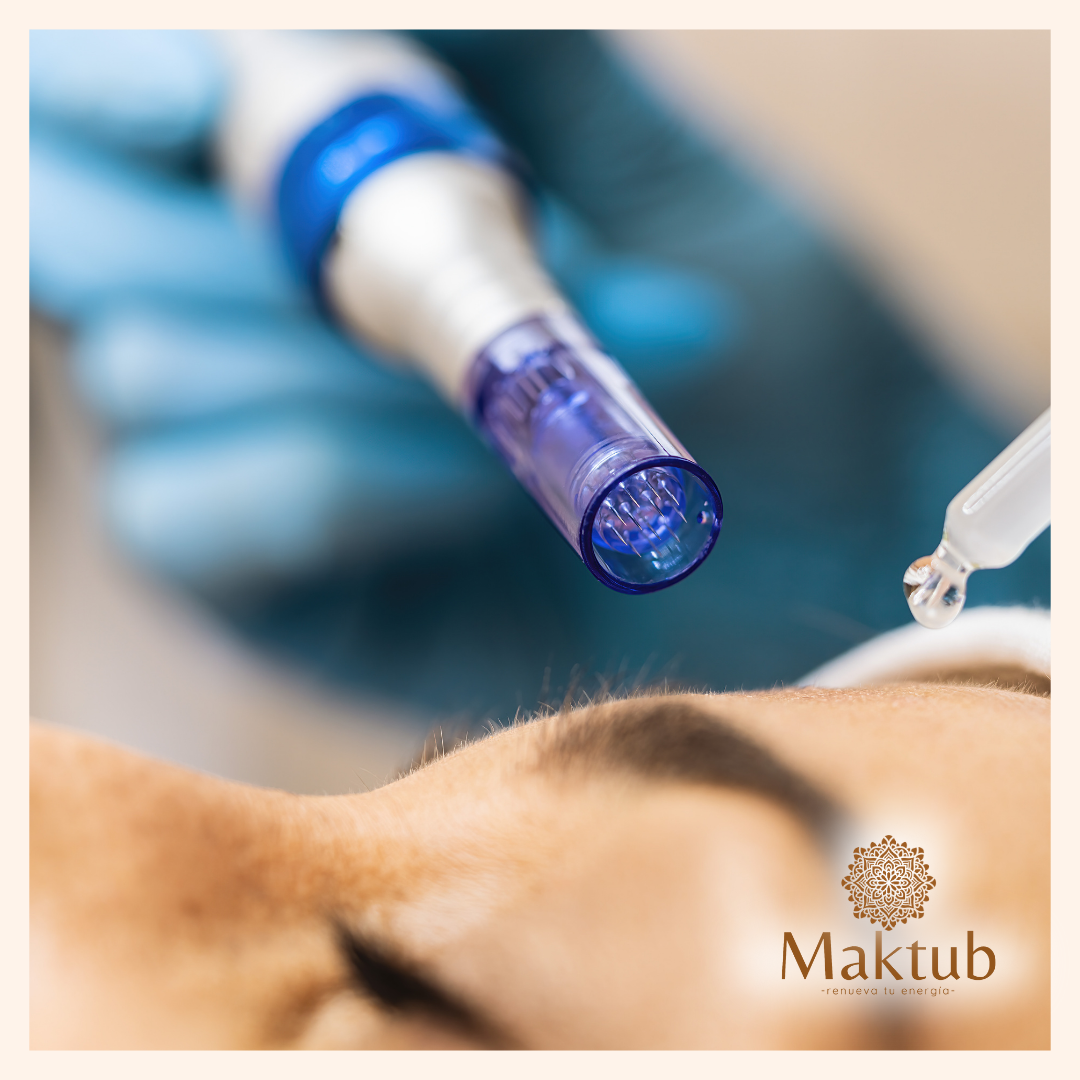 DERMAHEAL DERMAPEN 1 SESION